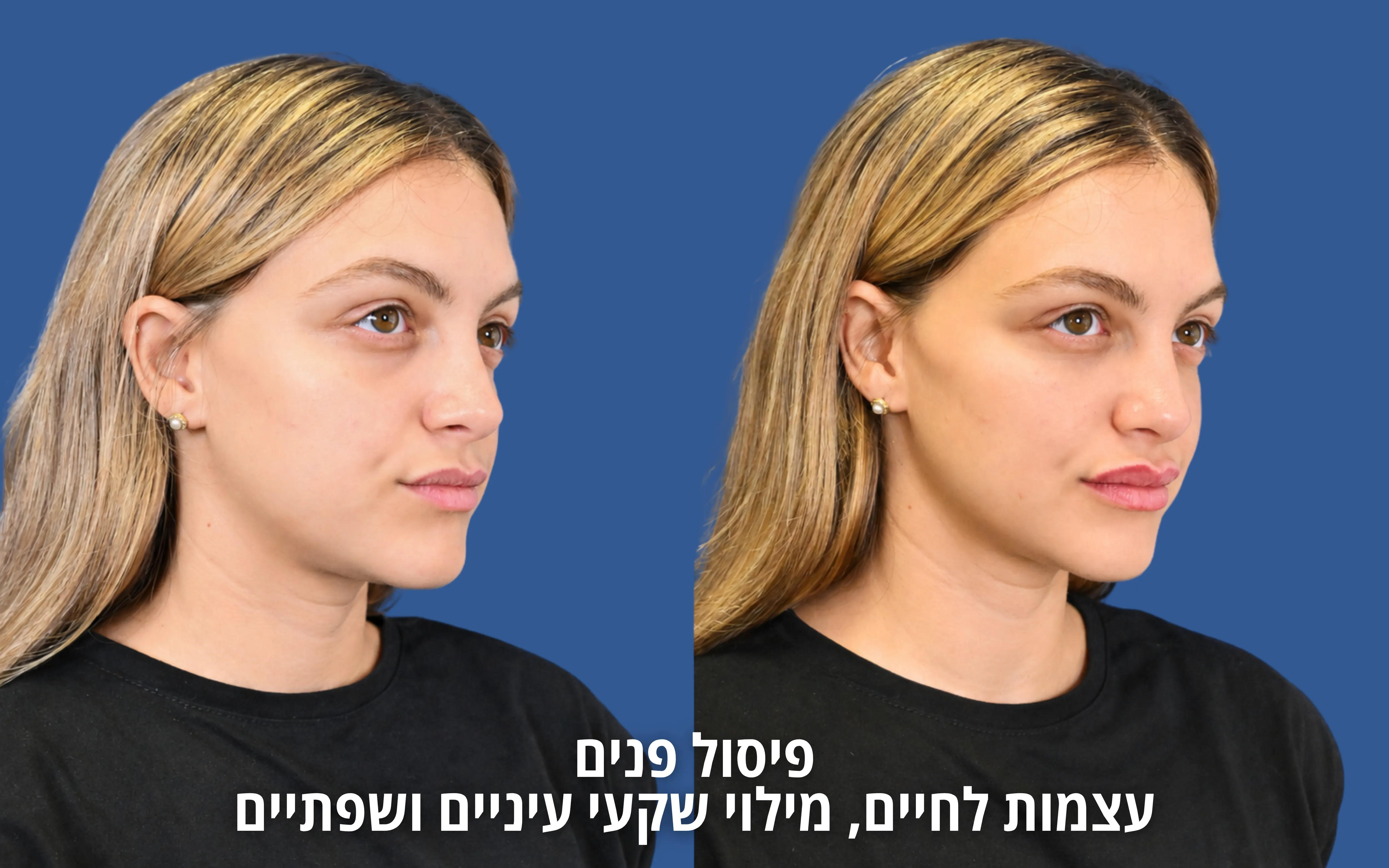 טיפול אסתטי רפואי לפני ואחרי במראה טבעי
